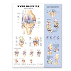 Knee Injuries Anatomical Chart de Anatomical Chart Company