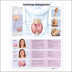 Thyroid Disorders Anatomical Chart de Anatomical Chart Company