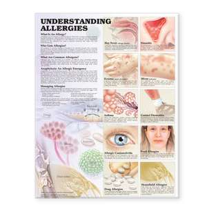 Understanding Allergies Anatomical Chart de Anatomical Chart Company