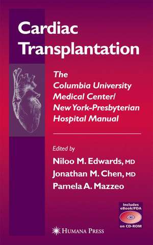 Cardiac Transplantation: The Columbia University Medical Center/New York-Presbyterian Hospital Manual de Niloo M. Edwards