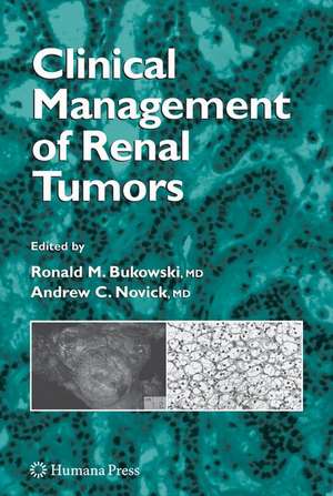 Clinical Management of Renal Tumors de Ronald M. Bukowski