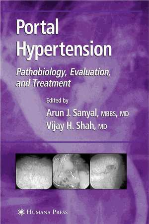 Portal Hypertension: Pathobiology, Evaluation, and Treatment de Arun J. Sanyal