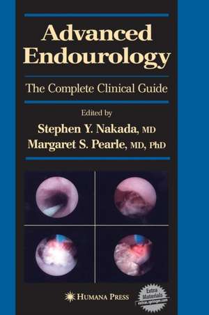 Advanced Endourology: The Complete Clinical Guide de Stephen Y. Nakada