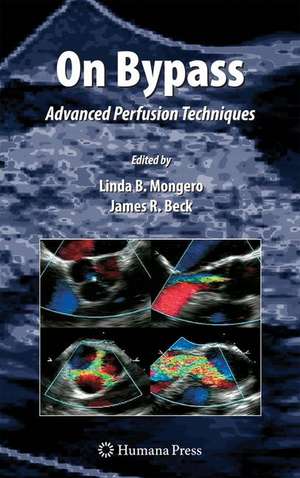 On Bypass: Advanced Perfusion Techniques de Linda B. Mongero