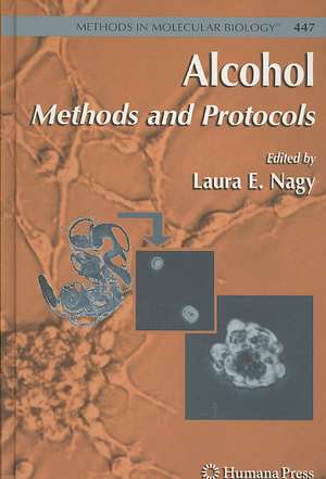 Alcohol: Methods and Protocols de Laura E. Nagy