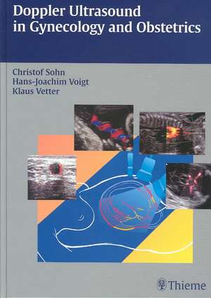 Doppler Ultrasound in Gynecology and Obstetrics de Christof Sohn