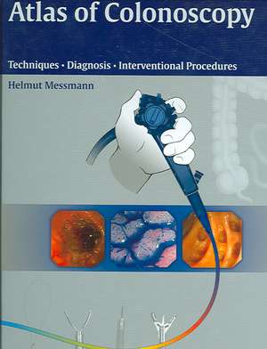 Atlas of Colonoscopy: Examination Techniques and Diagnosis de Helmut Messmann