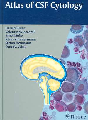 Atlas of CSF Cytology de Harald Kluge