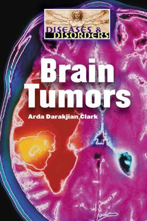 Brain Tumors de Arda Darakjian Clark