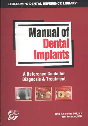 Manual of Dental Implants de DAVID P. SARMENT