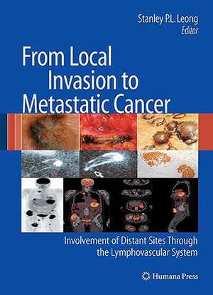 From Local Invasion to Metastatic Cancer: Involvement of Distant Sites Through the Lymphovascular System de Stanley P. L. Leong