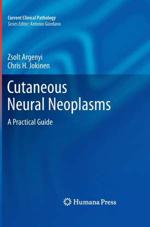 Cutaneous Neural Neoplasms: A Practical Guide de Zsolt Argenyi