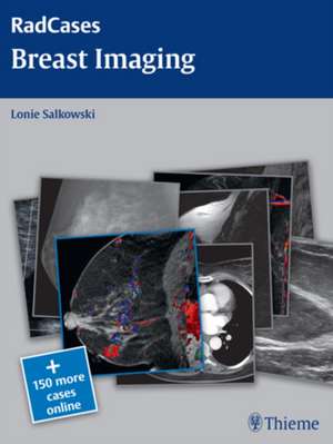 Radcases Breast Imaging de Lonie L. Salkowski