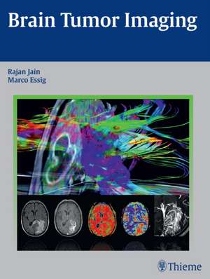 Brain Tumor Imaging de Rajan Jain