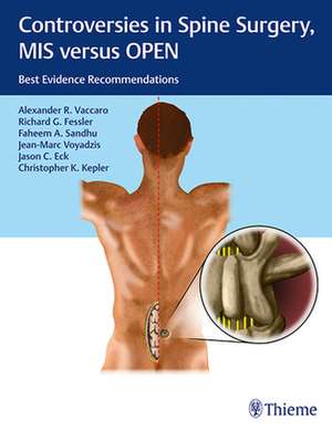 Controversies in Spine Surgery, MIS versus OPEN – Best Evidence Recommendations de Alexander R. Vaccaro