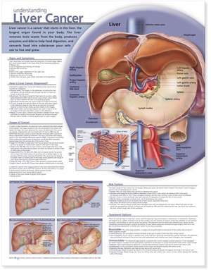 Understanding Liver Cancer Anatomical Chart de Anatomical Chart Company