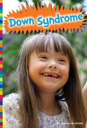 Down Syndrome de Michelle Levine