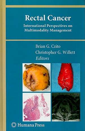 Rectal Cancer: International Perspectives on Multimodality Management de Brian G. Czito