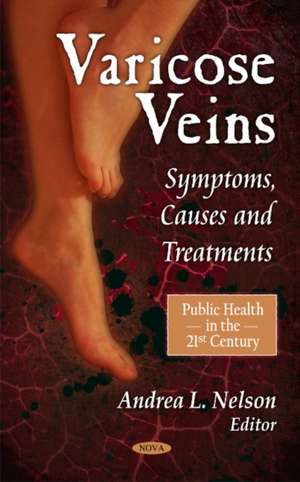 Varicose Veins de Andrea L. Nelson