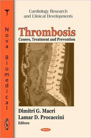 Thrombosis de Addison K. Wood