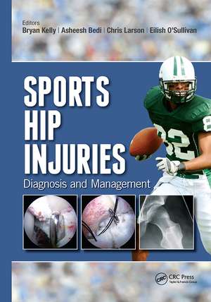 Sports Hip Injuries: Diagnosis and Management de Bryan Kelly