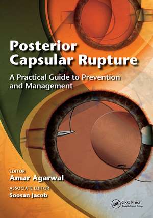 Posterior Capsular Rupture: A Practical Guide to Prevention and Management de Amar Agarwal