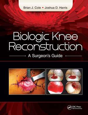 Biologic Knee Reconstruction: A Surgeon's Guide de Brian Cole