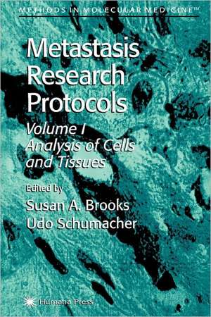 Metastasis Research Protocols de Susan A. Brooks