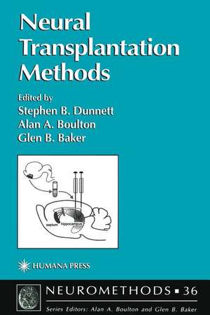 Neural Transplantation Methods de Stephen B. Dunnett