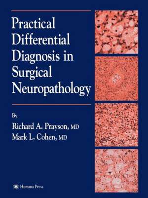 Practical Differential Diagnosis in Surgical Neuropathology de Richard A. Prayson