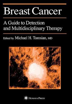 Breast Cancer: A Guide to Detection and Multidisciplinary Therapy de Michael H. Torosian