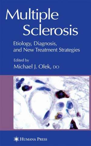Multiple Sclerosis de Michael Olek