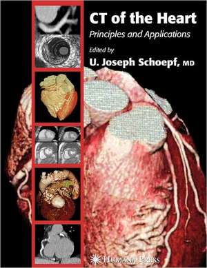 CT of the Heart: Principles and Applications de U. Joseph Schoepf