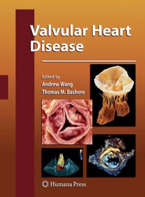 Valvular Heart Disease de Andrew Wang