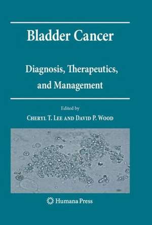 Bladder Cancer: Diagnosis, Therapeutics, and Management de Cheryl T. Lee