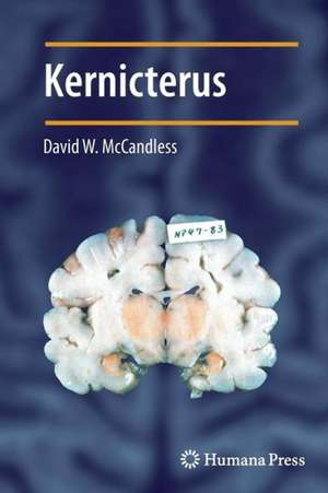 Kernicterus de David W. McCandless