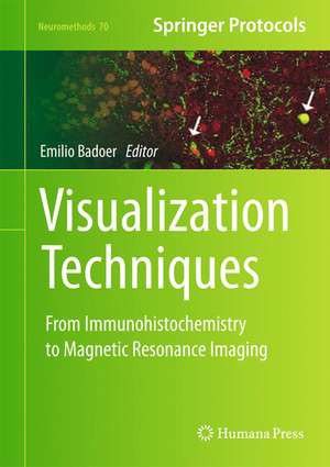 Visualization Techniques: From Immunohistochemistry to Magnetic Resonance Imaging de Emilio Badoer