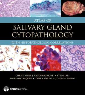 Atlas of Salivary Gland Cytopathology de Christopher J Vandenbussche