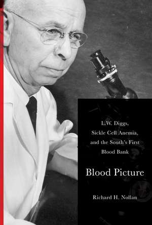 Blood Picture: L. W. Diggs, Sickle Cell Anemia, and the South's First Blood Bank de Richard Nollan