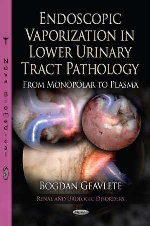 Endoscopic Vaporization in Lower Urinary Tract Pathology from Monopolar to Plasma de Bogdan Florin Geavlete