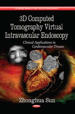 3D Computed Tomography Virtual Intravascular Endoscopy de Zhonghua Sun