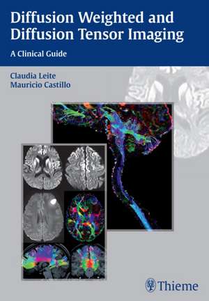 Diffusion Weighted and Diffusion Tensor Imaging – A Clinical Guide de Claudia Leite