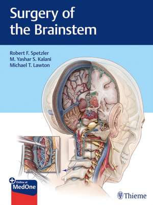 Surgery of the Brainstem de Robert F. Spetzler