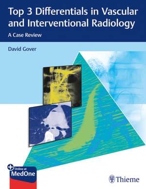 Top 3 Differentials in Vascular and Intervention – A Case Review de David D. Gover