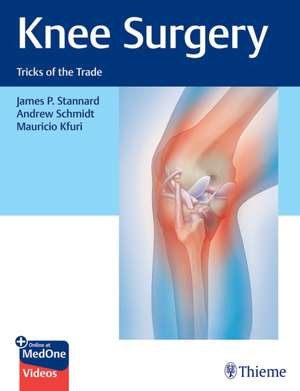 Knee Surgery: Tricks of the Trade de J Stannard