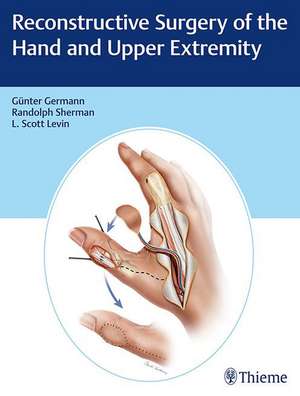 Reconstructive Surgery of the Hand and Upper Extremity de Gunter Germann