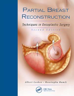 Partial Breast Reconstruction – Techniques in Oncoplastic Surgery de Albert Losken