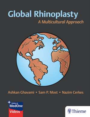 Global Rhinoplasty: A Multicultural Approach de Ashkan Ghavami