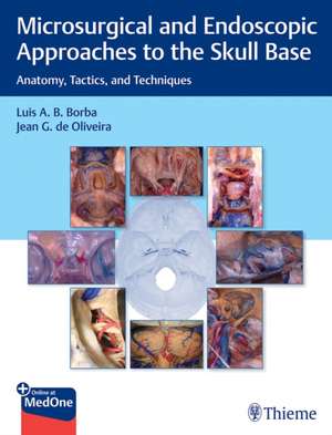 Microsurgical and Endoscopic Approaches to the S – Anatomy, Tactics, and Techniques de Luis Borba