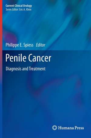 Penile Cancer de Philippe E Spiess